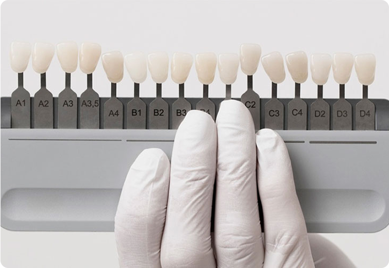 Dental Implants in Spain 