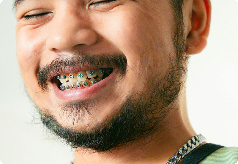  teeth cleaning hero image